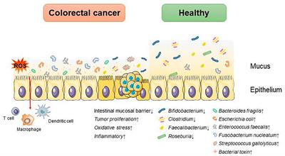 Postbiotics in colorectal cancer: intervention mechanisms and perspectives
